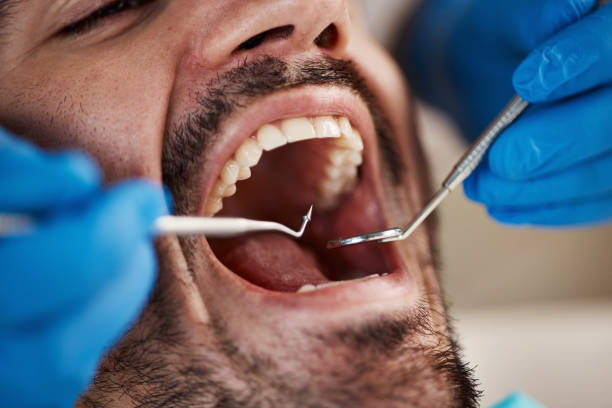 Best Emergency Dental Services for Seniors in Silver Lake, KS