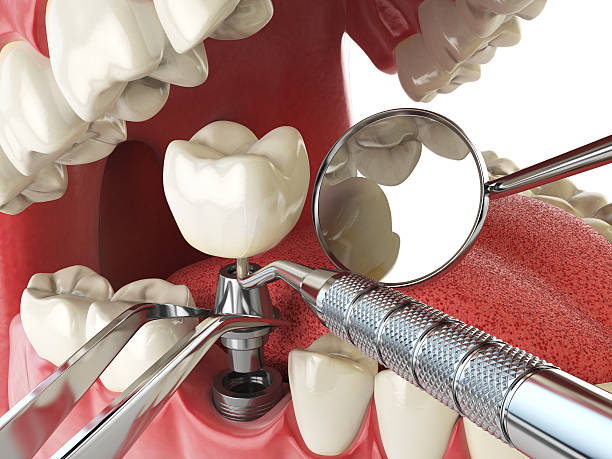 Best Emergency Dental Care for Abscessed Tooth in Silver Lake, KS